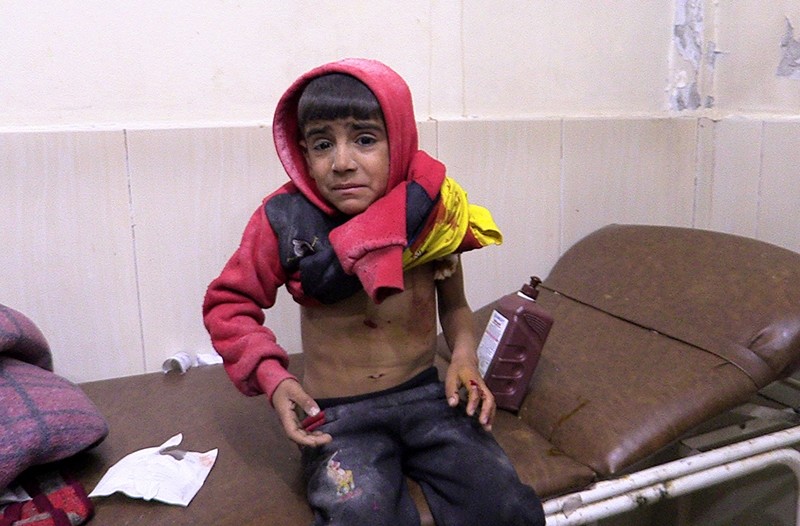 A child injured by Assad regime airstrike on Idlib receives medical treatment on Nov. 27, 2018. (AA Photo)