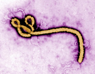 In this undated colorized transmission electron micrograph file image made available by the CDC shows an Ebola virus virion. (AP Photo)