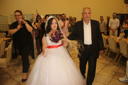 حفل زفاف رمزي لشابة تركية مصابة بمتلازمة داون