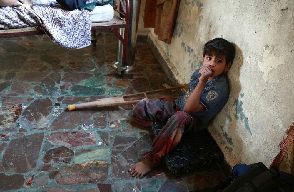  Some 206 children were reportedly killed due to malnutrition caused by the Syrian's regime blockade of East Ghouta.