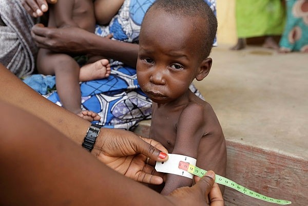A doctor attends to a malnourished child at a refugee camp in Yola, Nigeria. Doctors Without Borders says many refugees from Boko Haram have died of starvation and dehydration in the Nigerian city of Bama. (AP Photo)
