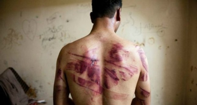 من ضحايا التعذيب في سجون الأسد من الأرشيف