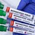 الصحة العالمية: لا ضرورة للتطعيم الجماعي ضد جدري القرود
