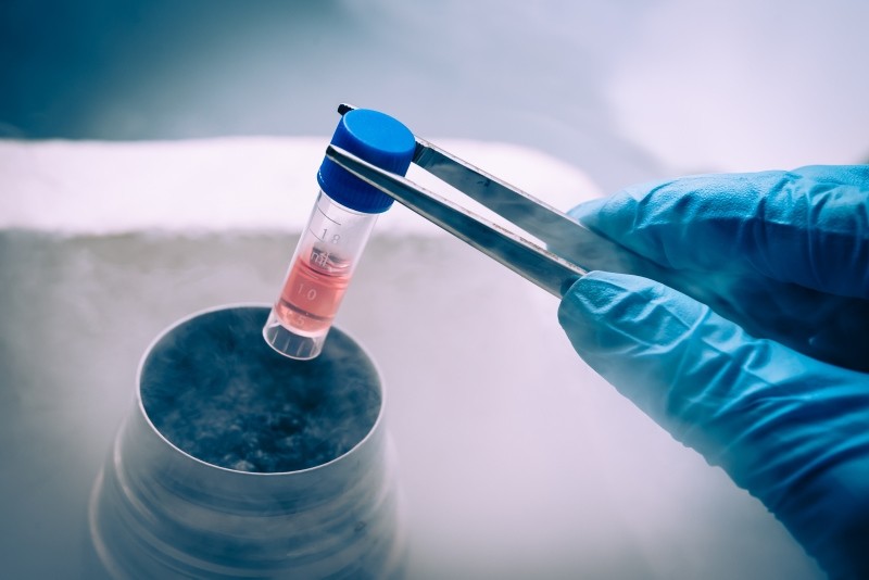 A Liquid Nitrogen bank containing suspension of stem cells. (FILE/ Getty Images/ iStockphoto)