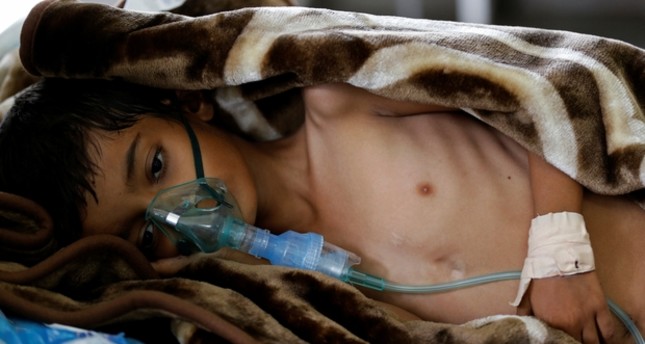 أطباء بلا حدود: الأعداد المتزايدة من إصابات الكوليرا تشكل مصدر قلق هائل في اليمن