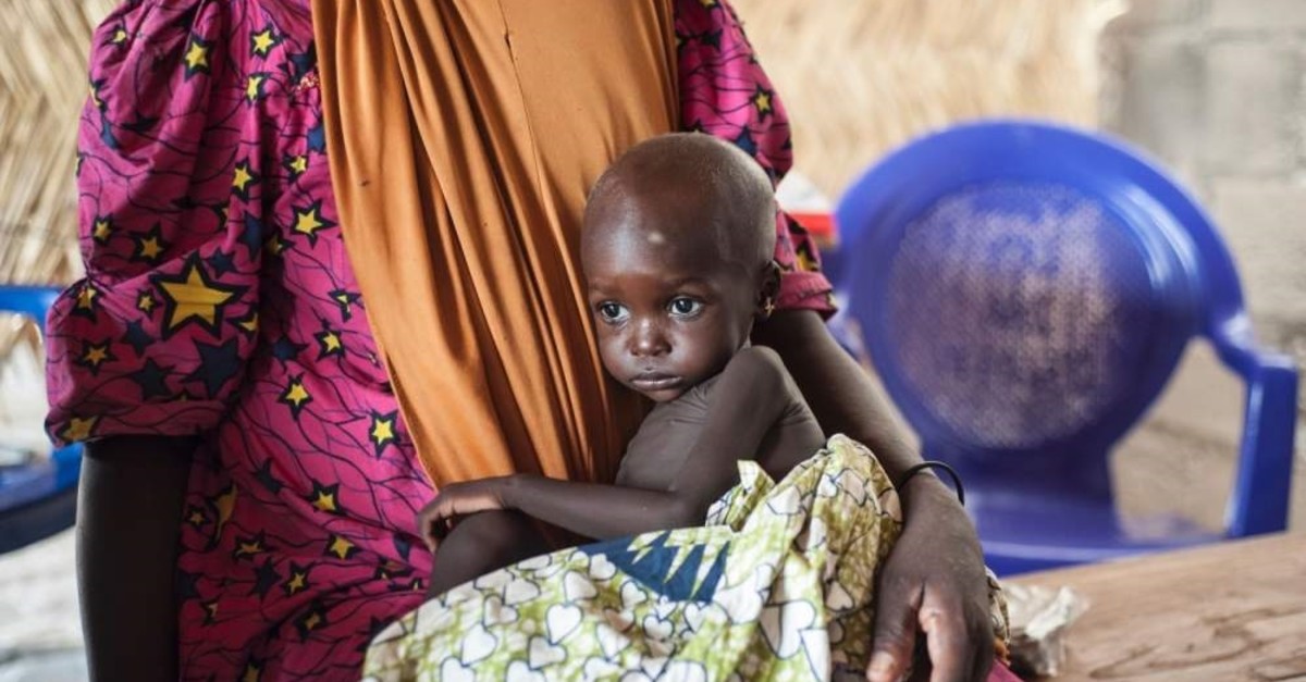 A young girl suffers from severe acute malnutrition sitting on her mother's lap in the outskirts of Maiduguri capital of Borno State, June 30, 2016. (AFP Photo)
