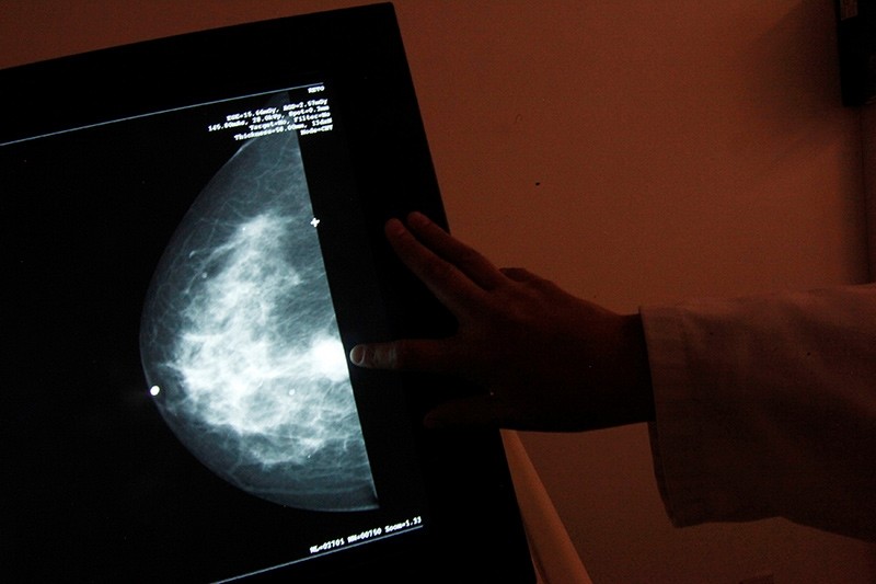  A monitor shows the image of a breast cancer at a centre run by the ,Reto, Group for Full Recovery of Breast Cancer in Mexico City (Reuters File Photo)
