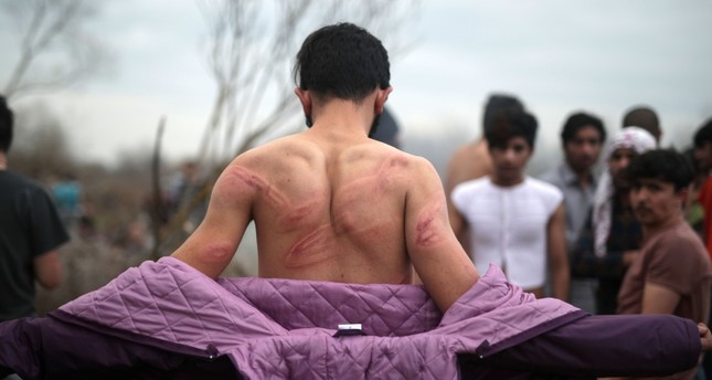 لاجئ يظهر ما تعرض له من ضرب على يد الشرطة اليونانية عند نهر مريج، 2020 الأناضول