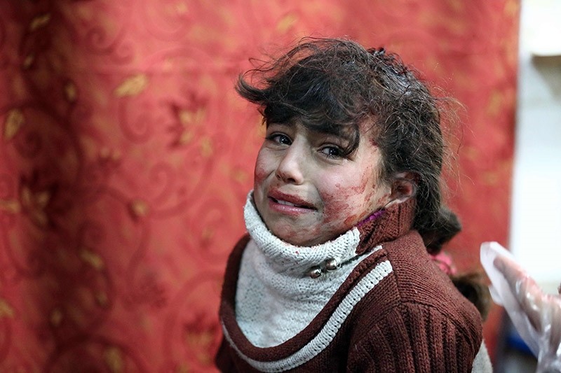 Hala, 9, receives treatment at a makeshift hospital following Syrian government bombardments on rebel-held town of Saqba, in the besieged Eastern Ghouta region on the outskirts of the capital Damascus on February 22, 2018. (AFP Photo)