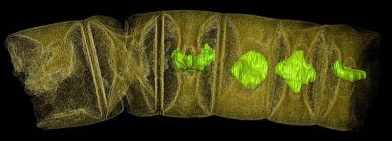 An X-ray tomographic picture of fossil thread-like red algae, tinted to show detail, unearthed in central India may represent the oldest-known plants on Earth, dating from 1.6 billion years ago. (Reuters Photo)