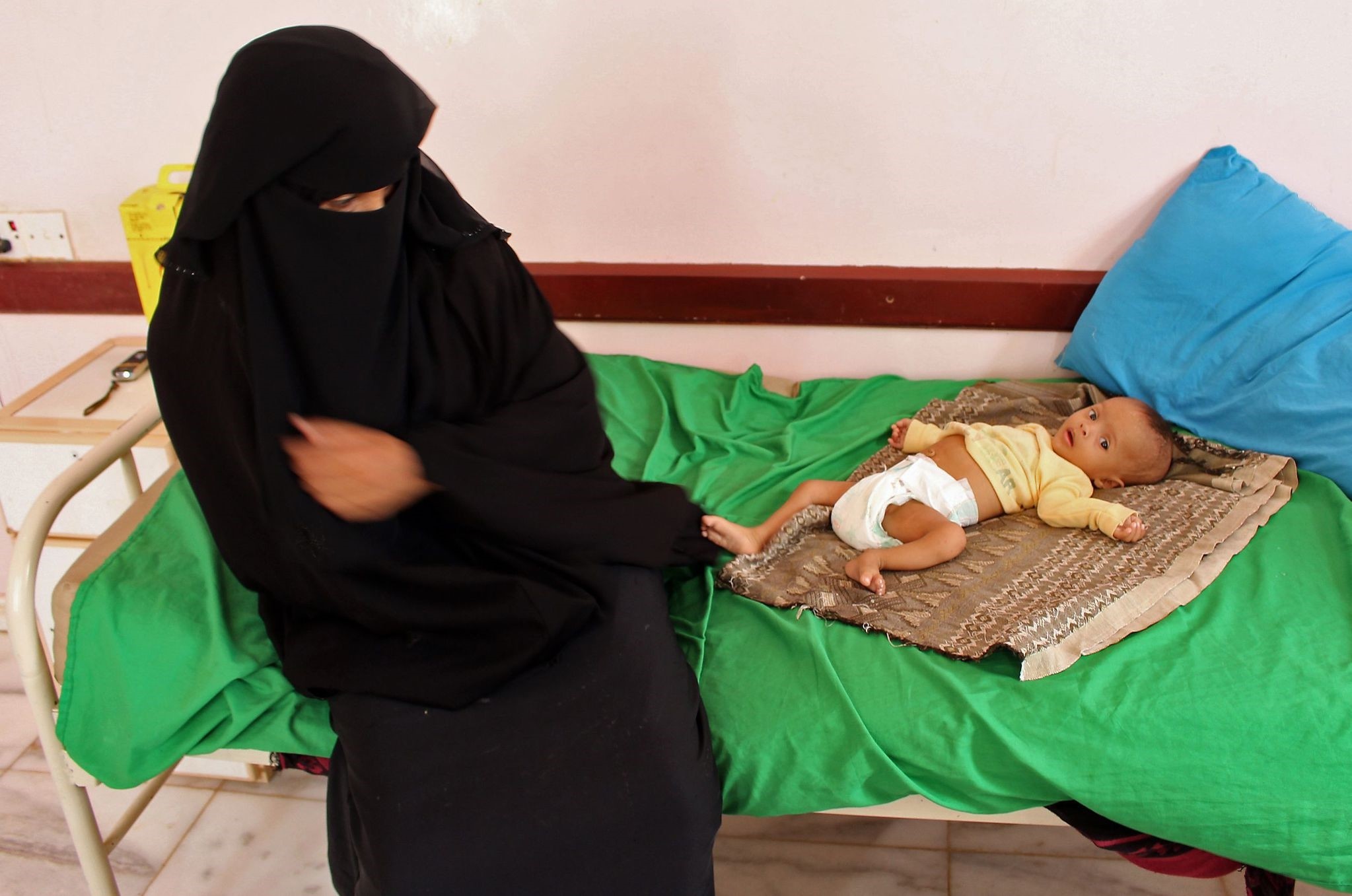 A Yemeni child suffering from severe malnutrition waits for treatment in a hospital in Yemenu2019s northwestern Hajjah province, Nov. 7.