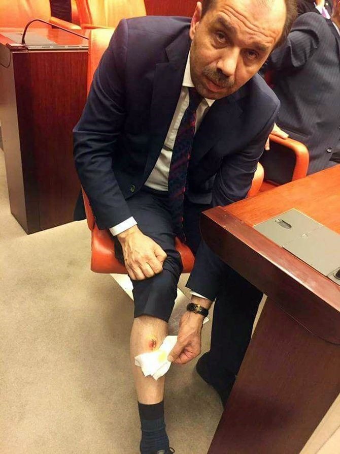 Balta shows his leg allegedly bitten by a CHP deputy.