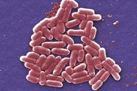 This 2006 colorized scanning electron micrograph image made available by the Centers for Disease Control and Prevention shows the O157:H7 strain of the E. coli bacteria. (CDC via AP Photo)