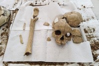 The skull and femur discovered is thought to belong to the Hittite era. (AA Photo)