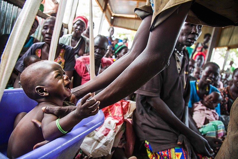 A mother weights her malnourished child on May 31, 2017, in a nutrition centre run by the International Rescue Committee (IRC)  in Panthau, Northern Bahr al Ghazal, South Sudan. (AFP Photo)