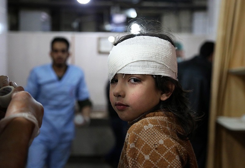 A wounded Syrian girl receives treatment at a make-shift hospital in Kafr Batna following Assad regime bombardments on the besieged eastern Ghouta region on the outskirts of the capital Damascus on February 21, 2018. (AFP Photo)