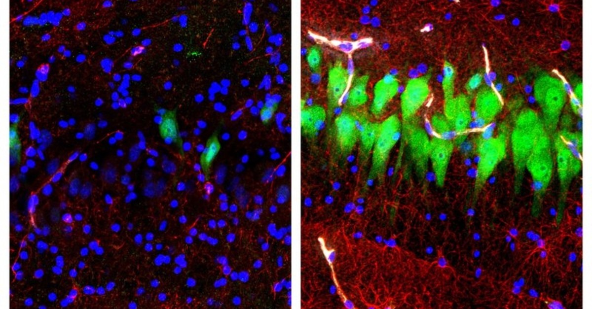 Images provided by the Yale School of Medicine in April 2019 shows stained microscope photos of neurons, astrocytes, and cell nuclei from a pig brain left untreated for 10 hours after death, and another with a blood substitute. (AP Photo)