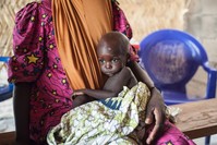 A young girl suffers from severe acute malnutrition sitting on her mother's lap in the outskirts of Maiduguri capital of Borno State, June 30, 2016. (AFP Photo)