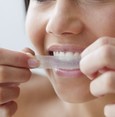 أطباء أسنان يحذرون من منتجات تقويم الأسنان وتبييضها التي يروج لها المؤثرون