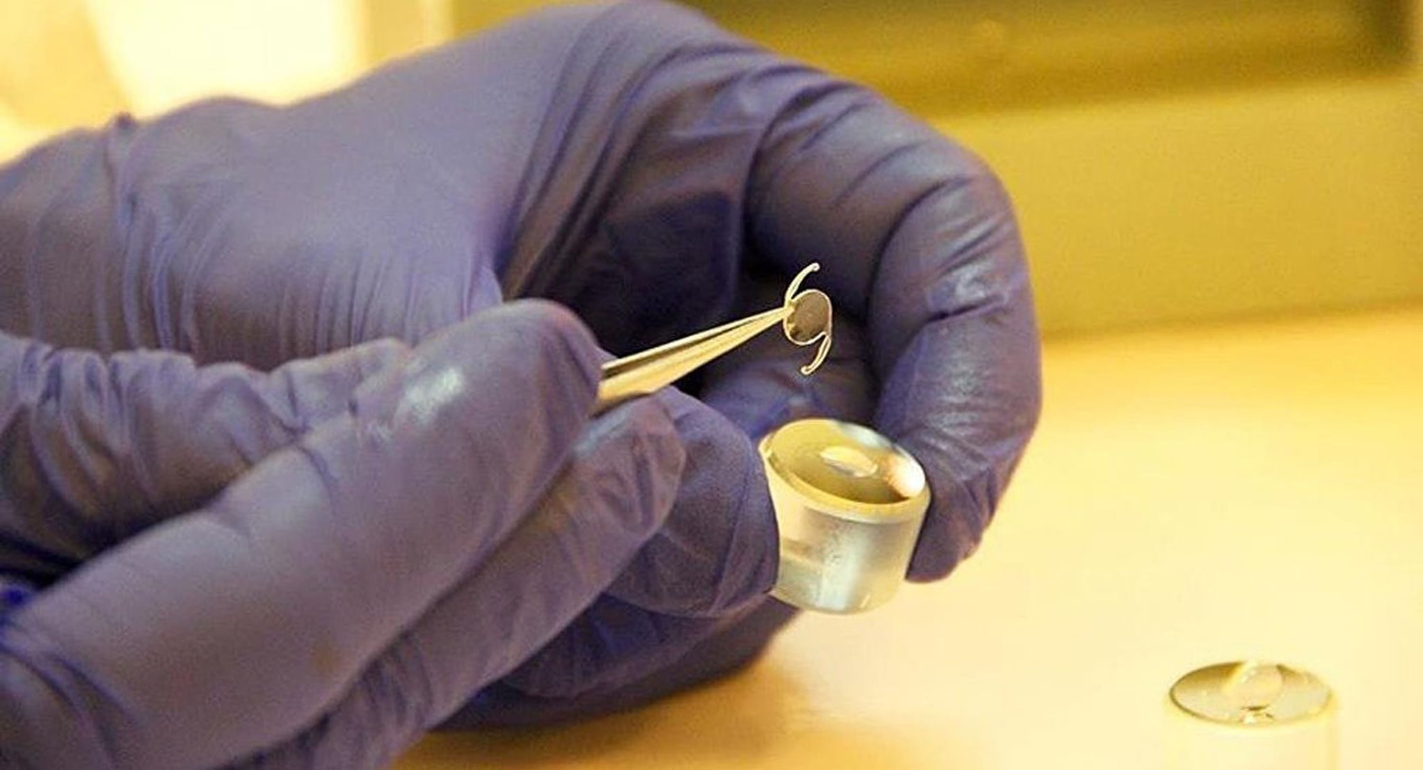 Surgeons remove 27 'missing' contact lenses in woman's eye in London