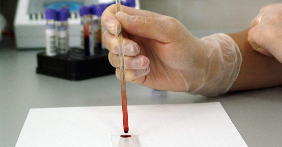 The new blood test developed by Toshiba can reportedly detect cancer in just two hours. (FILE PHOTO)