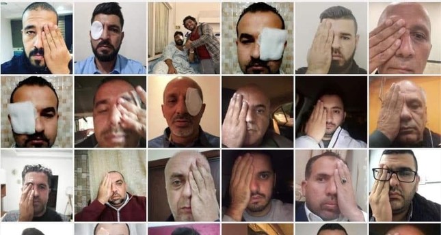 ضمادات على العيون تتضامن مع مصور فلسطيني سلب الاحتلال عينه