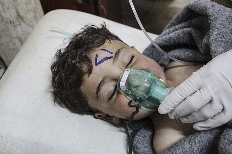 A Syrian child receives treatment after an alleged chemical attack at a field hospital in Saraqib, Idlib province, northern Syria, 04 April 2017. (EPA Photo)