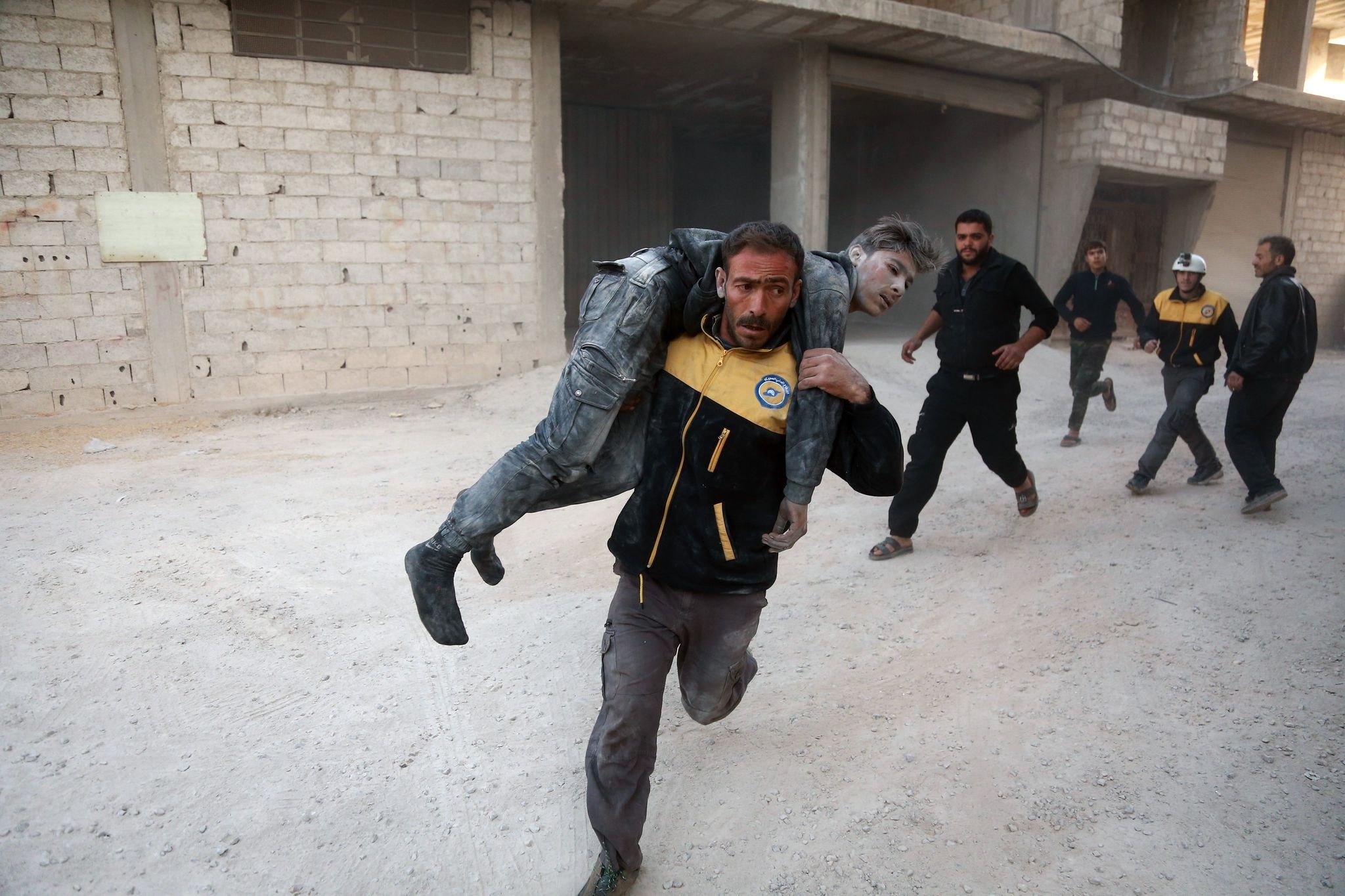A wounded Syrian is carried by a member of the Syrian Civil Defence, known as the white helmets, to a hospital in the opposition-held besieged town of Arbin, in the eastern Ghouta region. (AFP Photo)