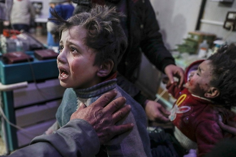  Injured children are treated at a hospital in rebel-held Douma, Eastern Ghouta (EPA Photo)