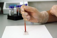 The new blood test developed by Toshiba can reportedly detect cancer in just two hours. (FILE PHOTO)