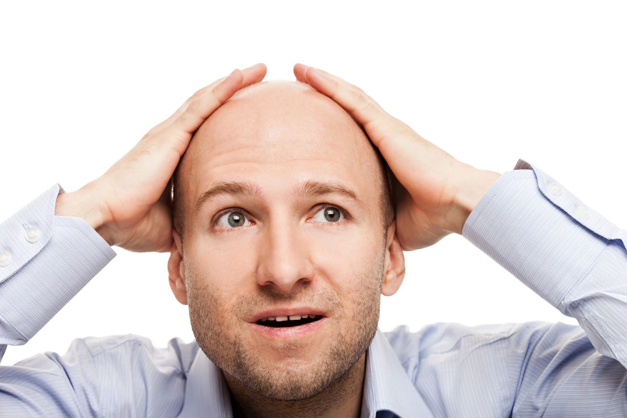 Short, white men more likely to go bald Daily Sabah
