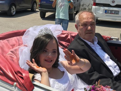حفل زفاف رمزي لشابة تركية مصابة بمتلازمة داون