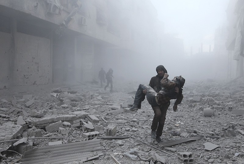 A wounded man is carried following an air strike on the rebel-held besieged town of Arbin, in the eastern Ghouta region on the outskirts of the capital Damascus on January 2, 2018. (AFP Photo)