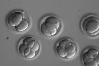 Oregon Health & Science University via AP