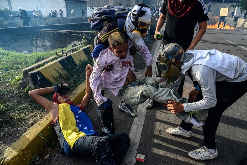 Opposition demonstrators help two injured fellow demonstrators during clashes with riot police on May 31, 2017. (AFP Photo)