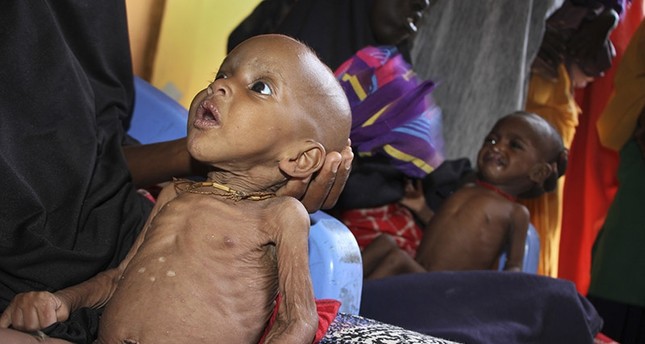 In this photo taken Saturday, Feb. 25, 2017, malnourished baby Ali Hassan, 9-months-old, left, is held by his mother Fadumo Abdi Ibrahim at a feeding center in a camp in Mogadishu, Somalia. (AP Photo)