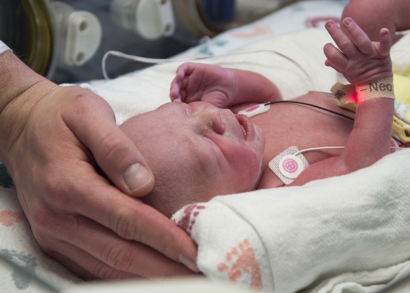 n this undated photo provided by Baylor University Medical Center the first baby born as a result of a womb transplant in the United States lies in the neonatal unit at Baylor University Medical Center in Dallas (AP Photo)